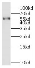      anti- BVES antibody