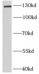      anti- BNC2 antibody