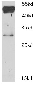      anti- BNIP3L antibody