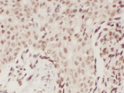 BRCA1抗体