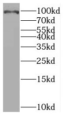      anti- BRCA1 antibody