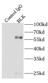     anti- BLK antibody