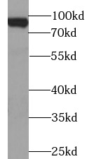      anti- BACH1 antibody