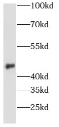      anti- Aurora A antibody