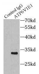      anti- ATP6V1E1 antibody