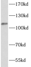      anti- ATP12A antibody