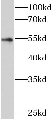 anti- ATG5 antibody