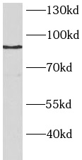      anti- BAP1 antibody