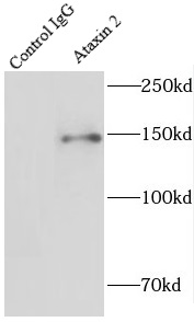      anti- Ataxin 2 antibody