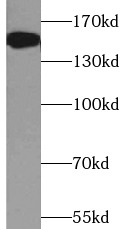      anti- Ataxin 2 antibody