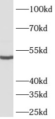      anti- ATG4C antibody
