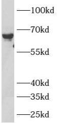     anti- ATL2 antibody