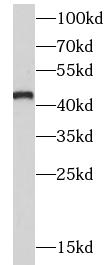      anti- ASS1 antibody