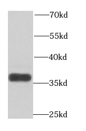      anti- ART5 antibody