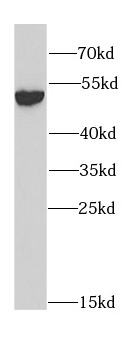     anti- ALDH2 antibody