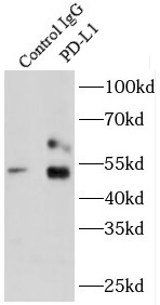      anti- PD-L1/CD274 antibody
