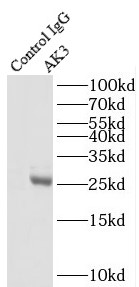      anti- AK3 antibody