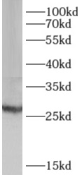      anti- AK3 antibody