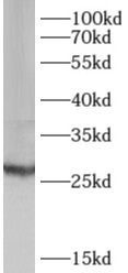      anti- AK3 antibody