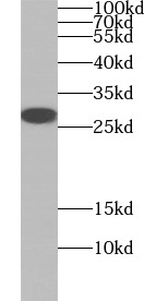      anti- AK2 antibody