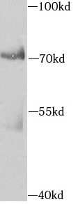      anti- AIFM3 antibody