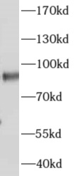      anti- AKAP4 antibody