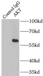      anti- AKT antibody