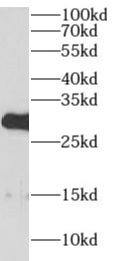      anti- AIG1 antibody