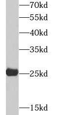      anti- AK3L1 antibody