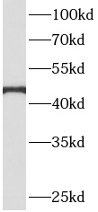      anti- AHCY antibody