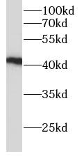      anti- ADH4 antibody