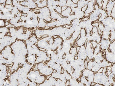 ACTA2/smooth muscle actin抗体