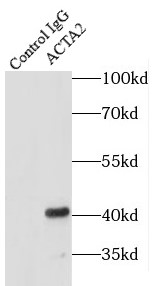      anti- ACTA2/smooth muscle actin antibody