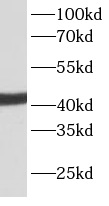      anti- ACTA2/smooth muscle actin antibody