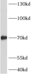      anti- ADAMTSL4 antibody