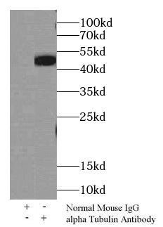 anti- alpha Tubulin antibody