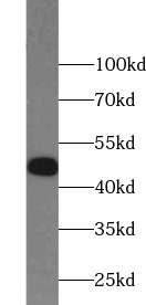      anti- Alpha-1-Antitrypsin antibody