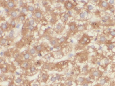 Angiotensinogen抗体