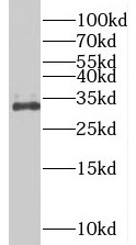      anti- BIVM antibody