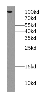      anti- USP1 antibody