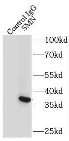      anti- SMN(human-Specific) antibody
