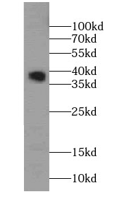      anti- SMN(human-Specific) antibody