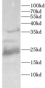      anti- HMGB1 antibody