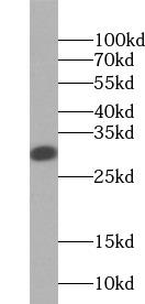 anti- TPSAB1 antibody