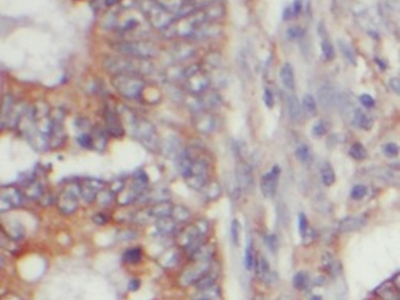      anti- Rac1 antibody