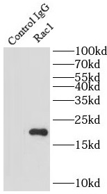 Rac1抗体