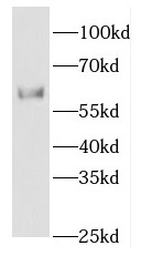      anti- ETV4 antibody