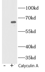 anti- Phospho-NF-kB p65-S536 antibody