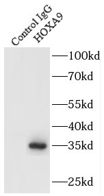 HOXA9抗体