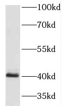      anti- HOXA9 antibody